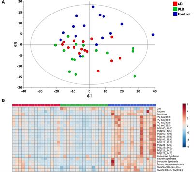 Plasma metabolites distinguish dementia with Lewy bodies from Alzheimer’s disease: a cross-sectional metabolomic analysis
